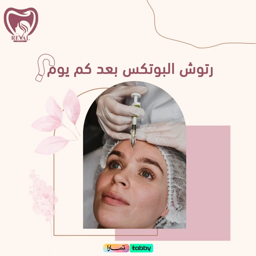 متى يبدأ مفعول البوتكس بعد جلسة الرتوش؟