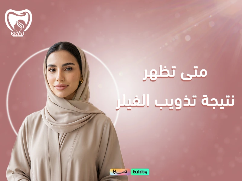 متى تظهر نتيجة تذويب الفيلر؟