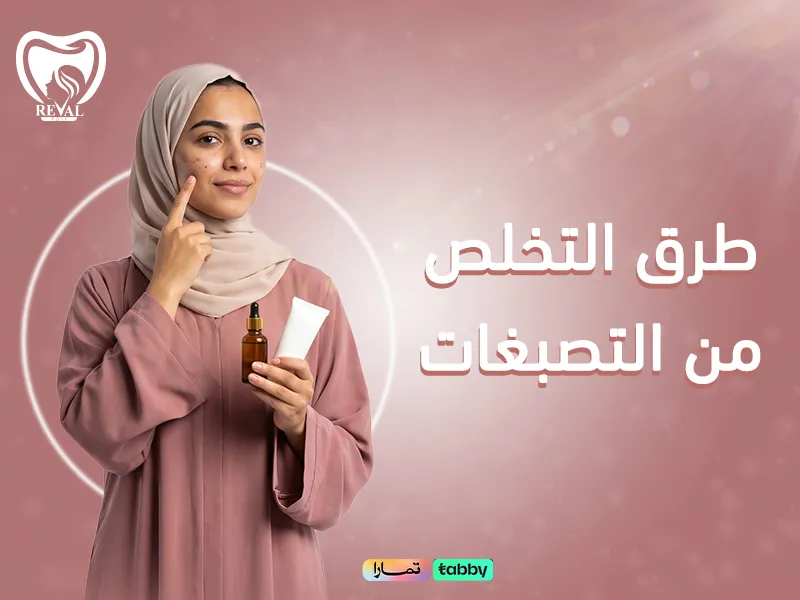طرق التخلص من التصبغات