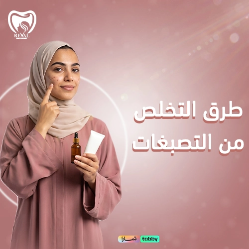 تجربتي مع علاج التصبغات
