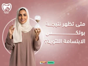 متى تظهر نتيجة بوتكس الابتسامة اللثوية؟ المدة والنتائج المتوقعة