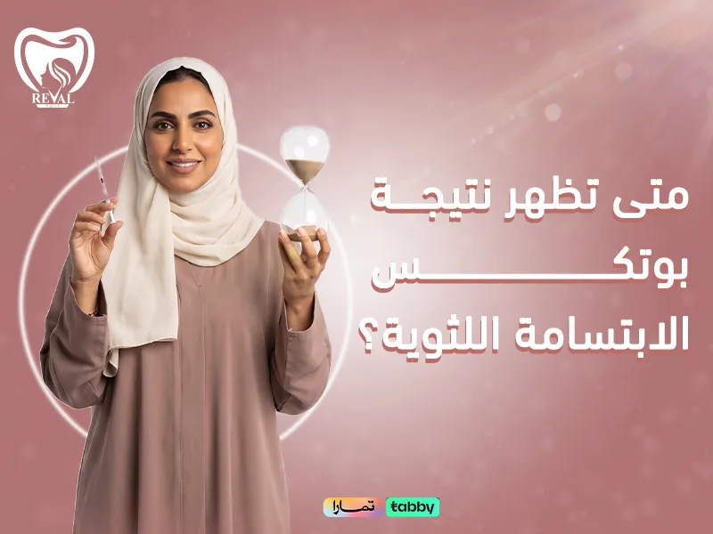 متى تظهر نتيجة بوتكس الابتسامة اللثوية؟ المدة والنتائج المتوقعة