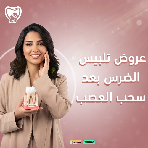 سعر تلبيس الضرس بعد سحب العصب