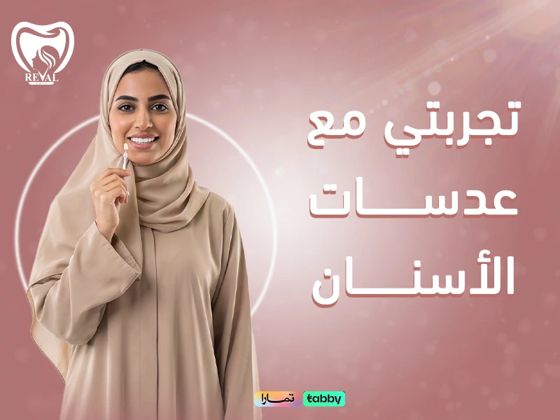 كيف غيرت تجربتي مع عدسات الأسنان مظهر ثقتي بنفسي للأبد بدون ألم أو انتظار