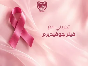 تجربتي مع فيلر جوفيديرم: ما الذي يحدث فعلًا قبل الحقن وبعده وكيف تُقيَّم النتيجة بأمان؟