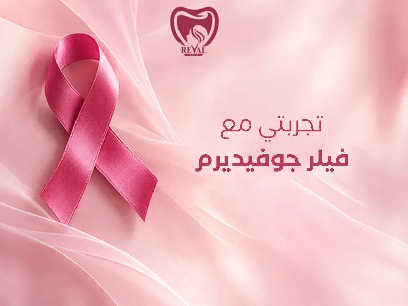 تجربتي مع فيلر جوفيديرم: ما الذي يحدث فعلًا قبل الحقن وبعده وكيف تُقيَّم النتيجة بأمان؟