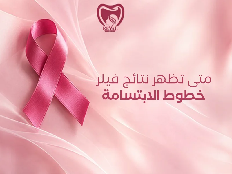 متى تظهر نتائج فيلر خطوط الابتسامة